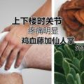 關節變形？雞血藤和仙人掌怎樣用才能消除滑膜炎