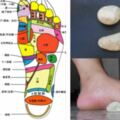 【不用花錢自然療法】踩踏卵石痛並健康著