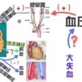 中風的元兇原來是「頸椎」，中風的患者部分經過及時的治療後遺症可以完全消除