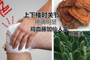 關節變形？雞血藤和仙人掌怎樣用才能消除滑膜炎