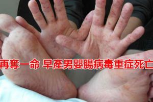 再奪一命中部早產男嬰腸病毒重症死亡~~5歲以下嬰幼兒為重症高危險群