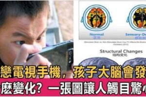 孩子經常「看電視、玩手機」會有什麼後果？來看一張大腦萎縮圖，英國科學家用事實說話