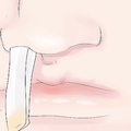 鼻塞太嚴重？只要衛生紙沾這個塞進鼻孔裡，30秒就能迅速解決！