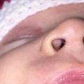 她發現小孩的鼻孔內長出了一些「微小的黑點」，這驚悚的成因讓她覺得不告訴大家不行！